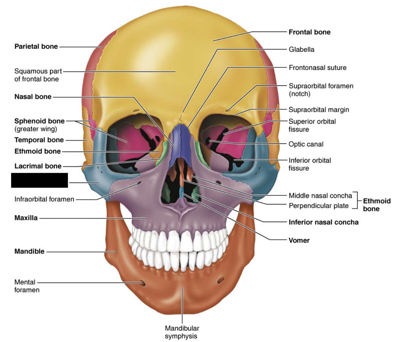What facial bones is this?