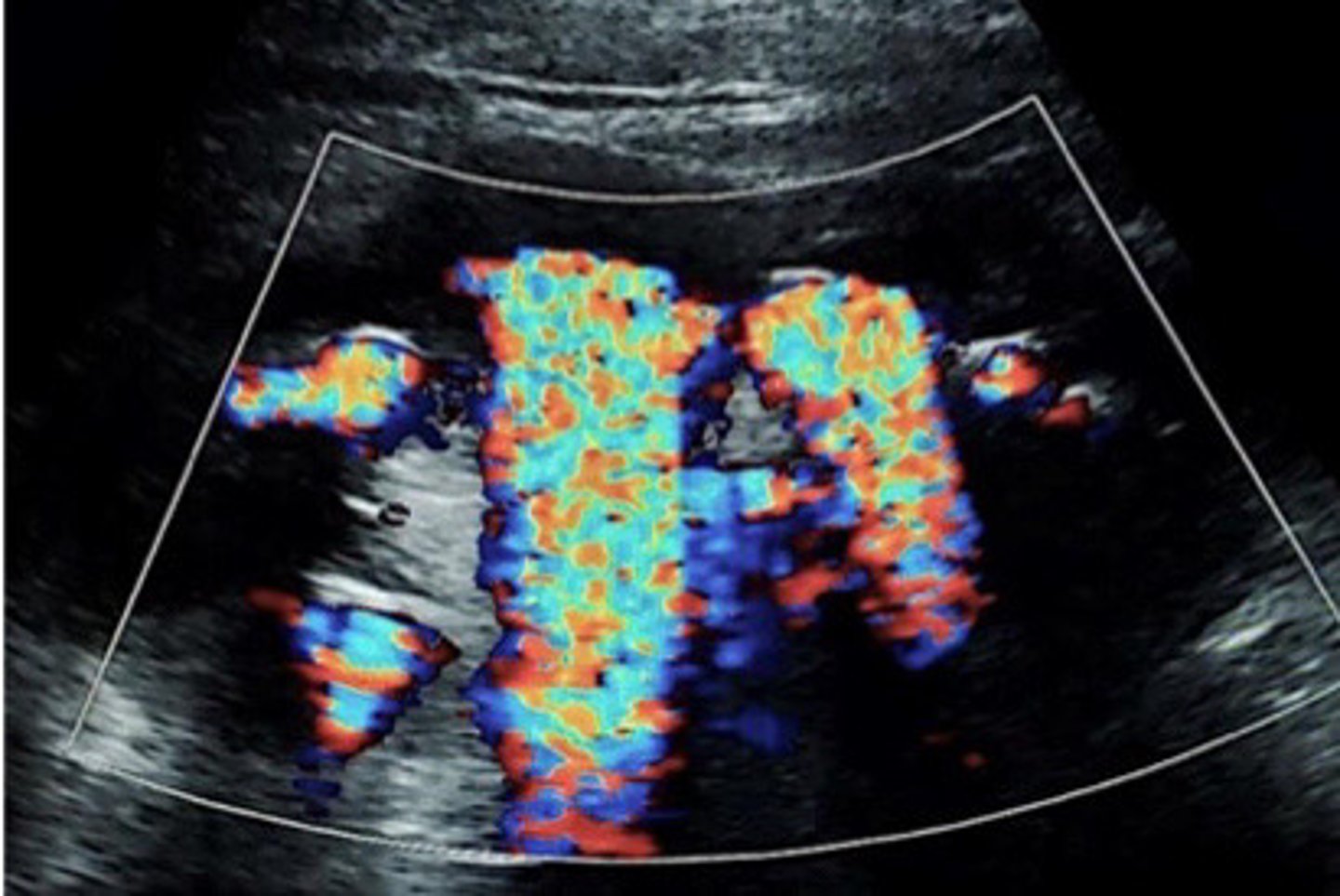 <p>What does this image show</p>