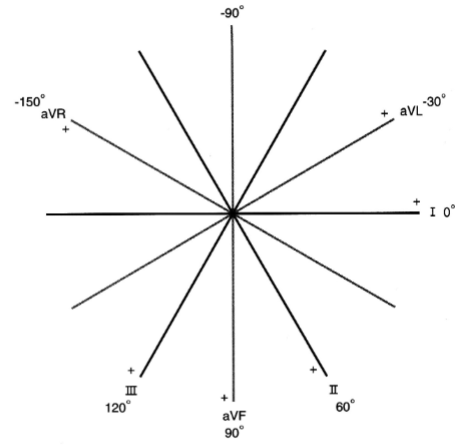 <p><span>- lead I : 0º</span><br><span>- lead II : +60º</span><br><span>- aVF: +90º</span><br><span>- lead III: +120º</span><br><span>- aVR: -150º</span><br><span>- aVL: -30º</span></p>