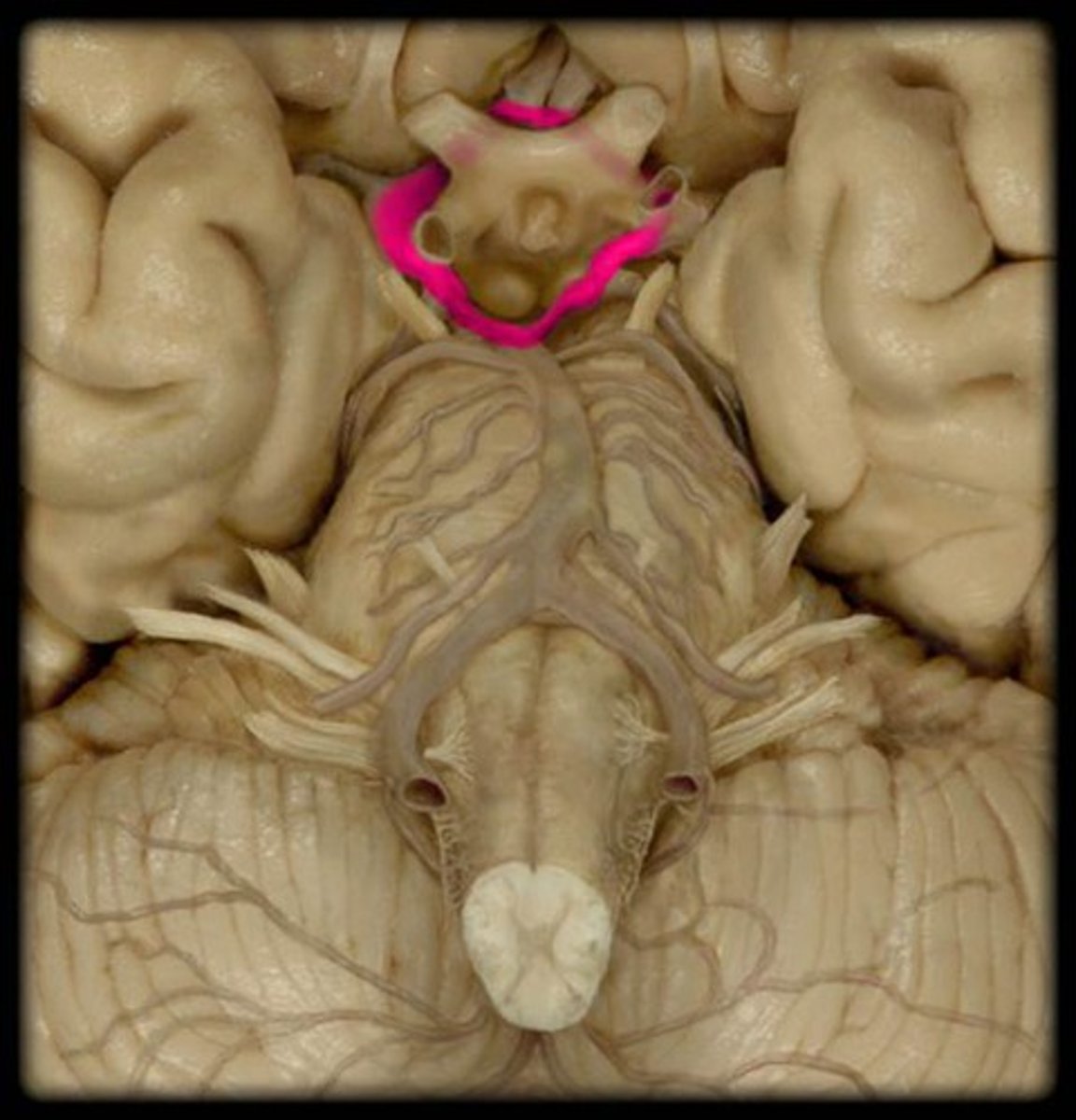 <p>Identify this specific vessel network. This network is also called the Circle of Willis.</p>