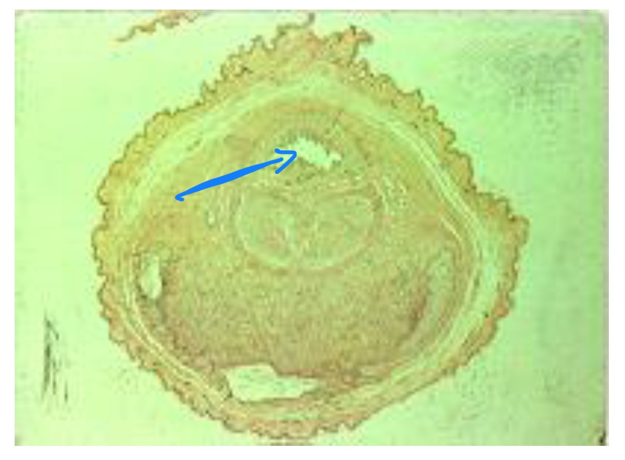 term image