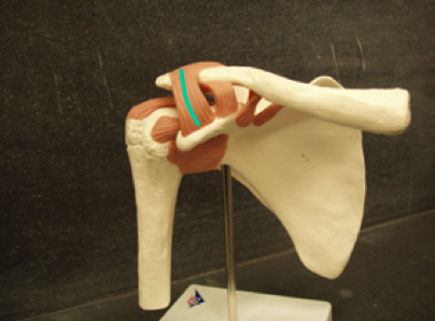 <p>Fx: connection between the coracoid process and the acromion</p>