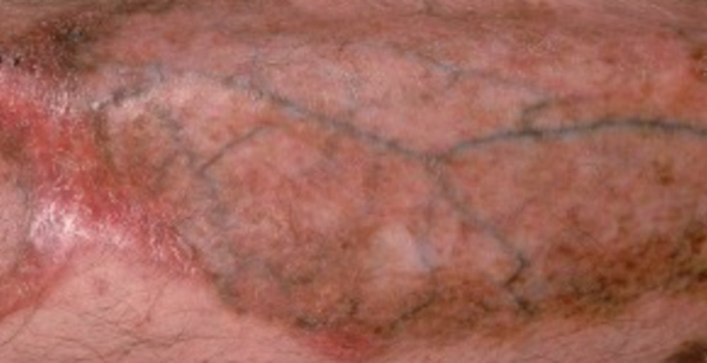 <p>What is the diagnosis?</p>