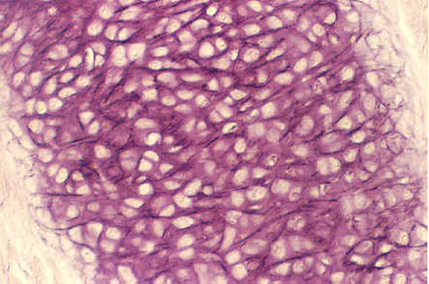 <p>cartilage with abundant elastic fibers; more flexible than hyaline cartilage- found on the pinna (external ear)</p>