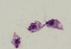 <p>Tritrichomonas fetus</p>