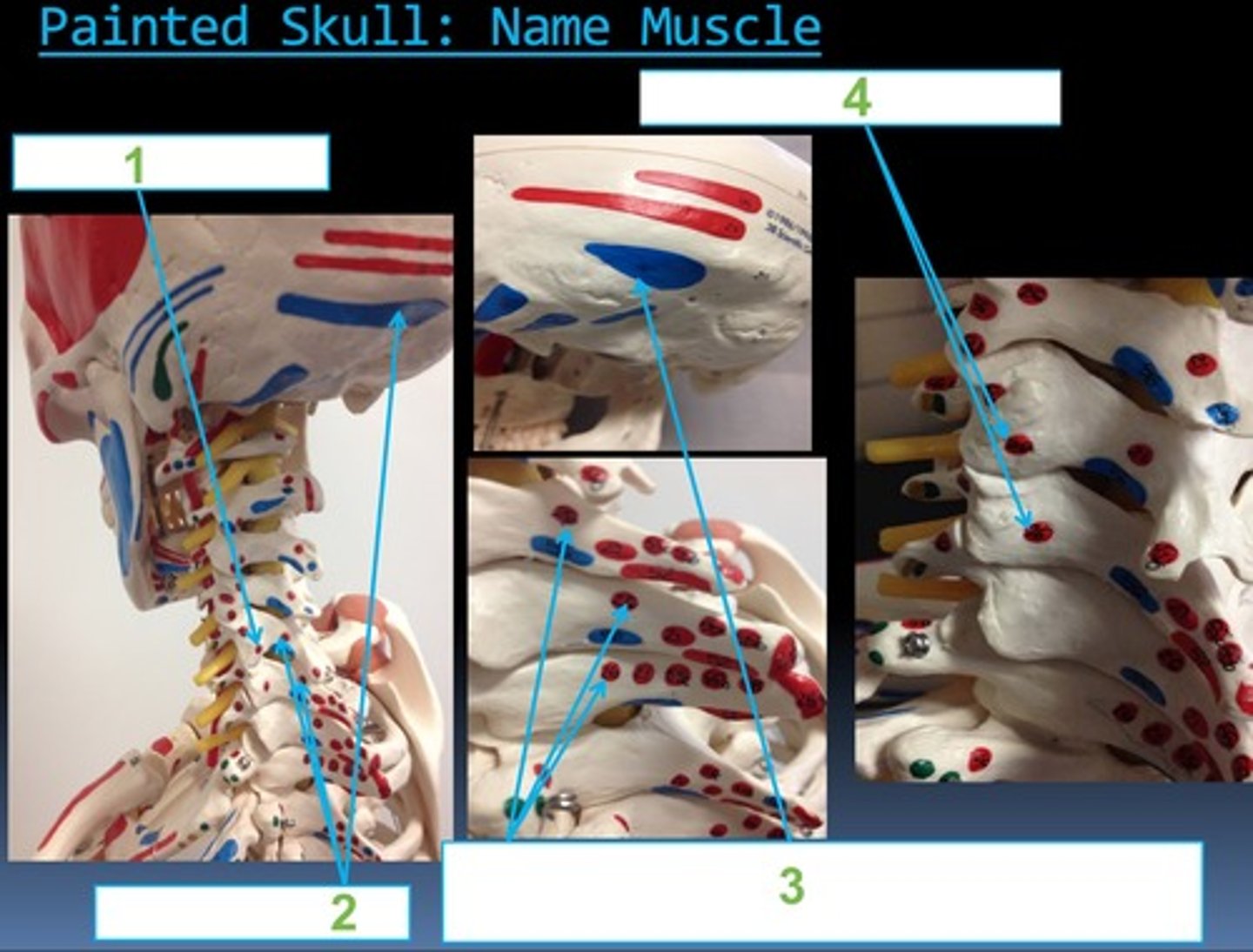 <p>26/3 insertion</p>