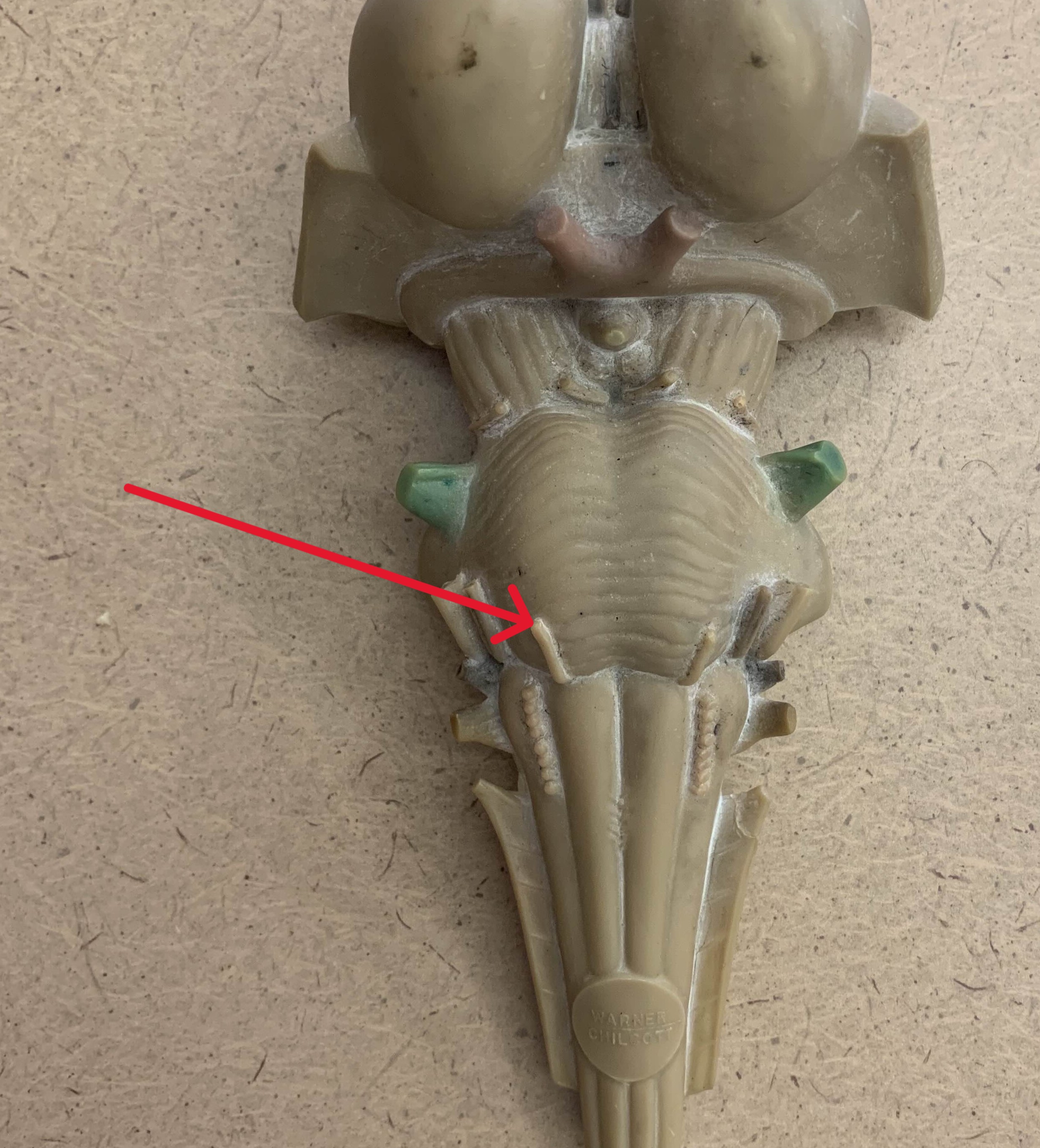 <p>Which nerve of the brain is:</p><ul><li><p>Below pons</p></li><li><p>Medial to facial nerve</p></li></ul><p></p>