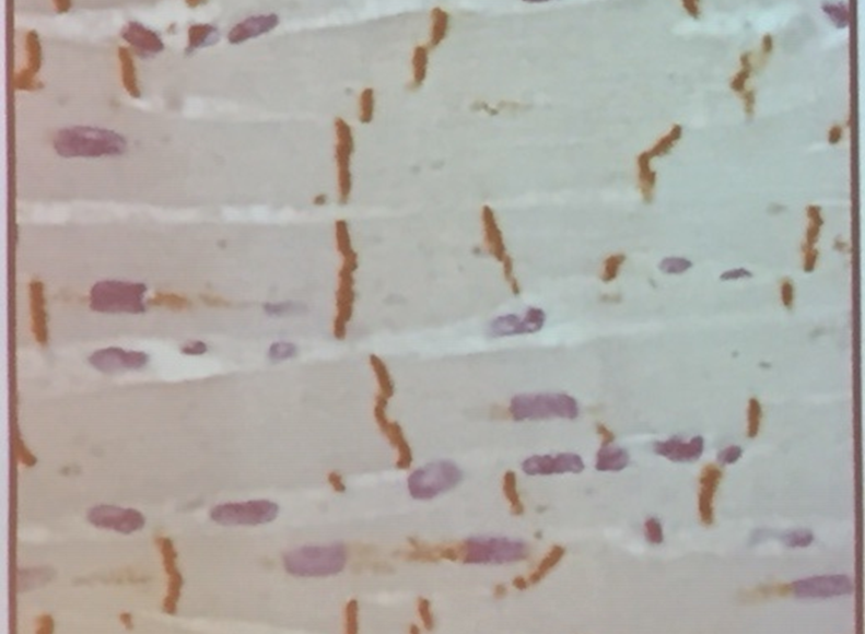 <p>while observing cardiac muscle under a microscope for the first time, the student noticed lines running perpendicular to the direction of he muscle as shown in the photo below. These lines are called</p>
