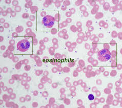 <p>eosinophils</p>