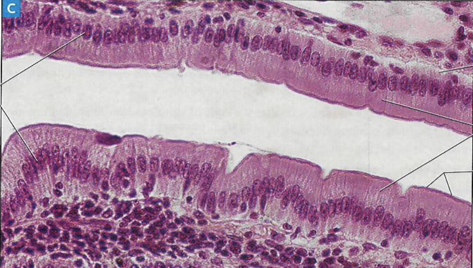 <p>What type of tissue is present in this image?</p>