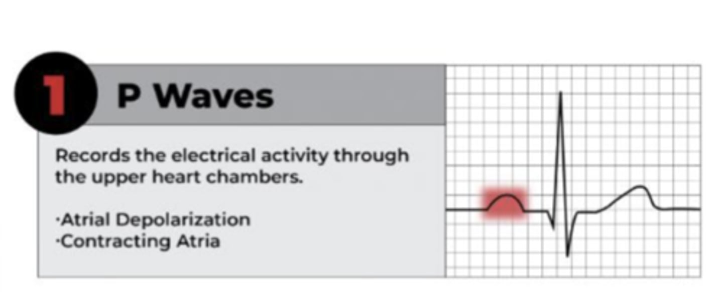 <p>• Upper heart chambers</p><p>• Represents atrial depolarization or contraction of atria</p>