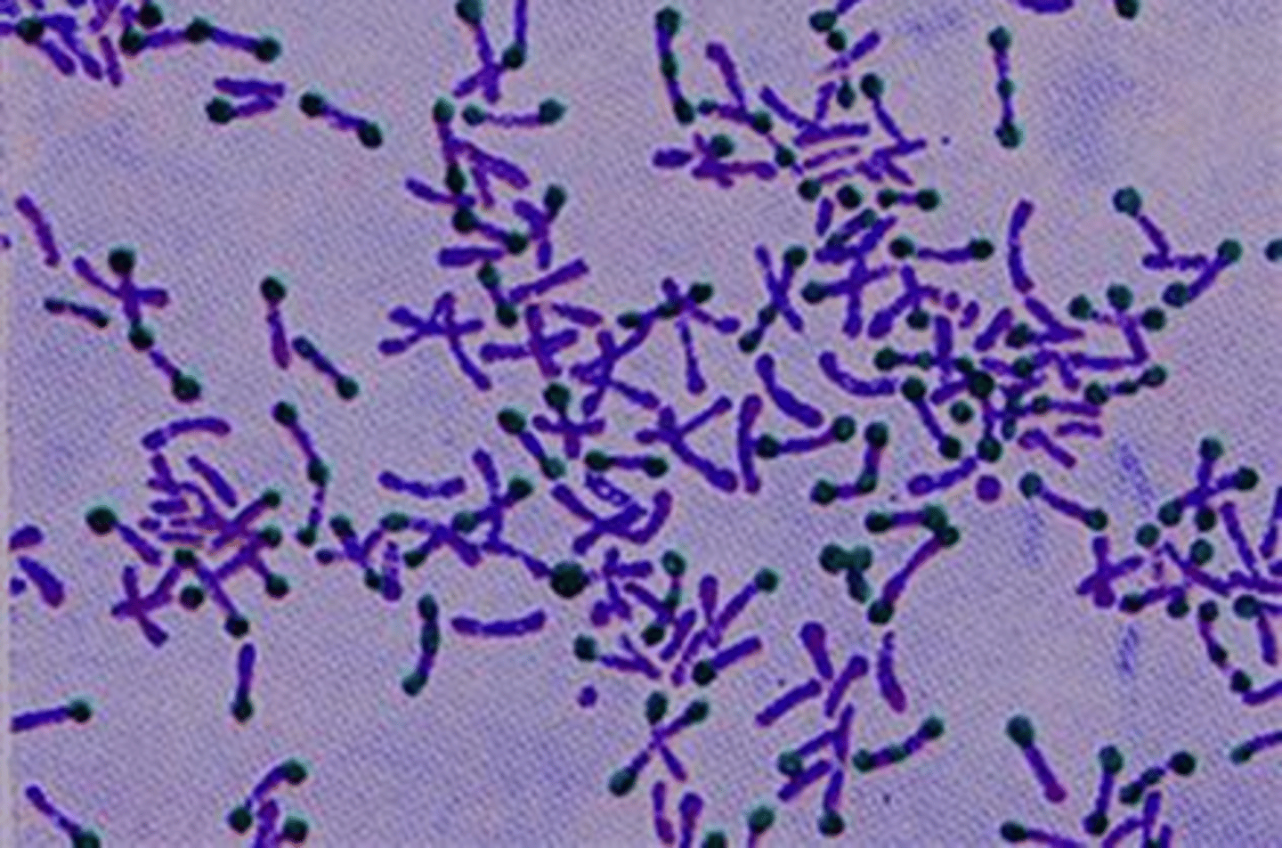 <p>Gram positive club-shaped rods</p><p>Affects the skin and urinary systems</p><p>Causes skin abscesses and urinary infections</p>