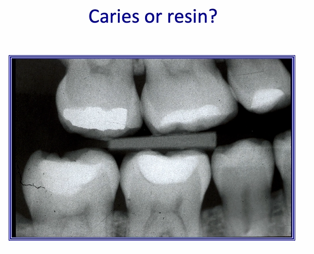 <p>can be difficult to thin down resin layers </p>