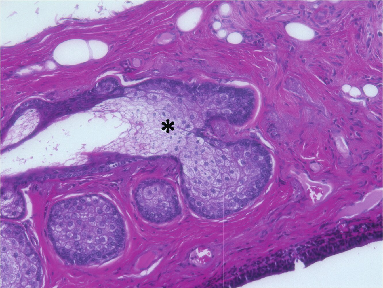 <p>15. The cells of the gland marked with a star in the image:</p><p>A. Develop increasingly pyknotic nuclei during their differentiation</p><p>B. Typically die by necrosis</p><p>C. Accumulate large amounts of peptides in secretory granules during differentiation</p><p>D. Decrease in size during differentiation</p><p>E. Primarily serve in thermoregulation</p>
