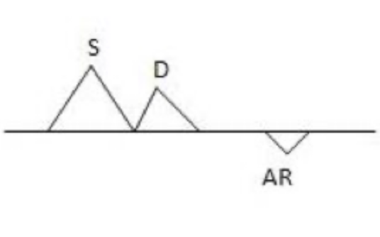 <p><span><span>The following image represents the Doppler flow pattern for</span></span></p>
