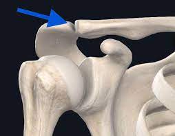 the joint formed by the acromion of the scapula and the clavicle
