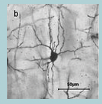 <p>Stellate (star-shaped) cell:</p><ul><li><p>SMALL </p></li><li><p>Many short DENDRITES extend around the CELL BODY </p></li><li><p>Short AXON </p></li></ul><p></p>