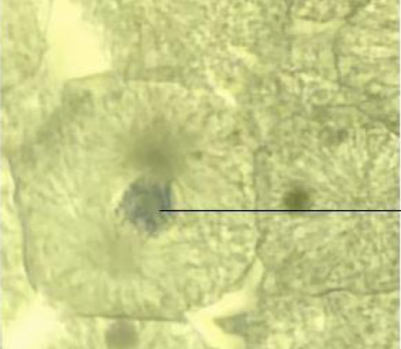 <p>What is the phase of the cell? What do the pointers point to?</p>
