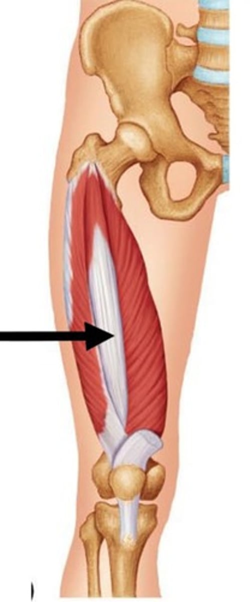 <p>(under rectus femoris)</p>