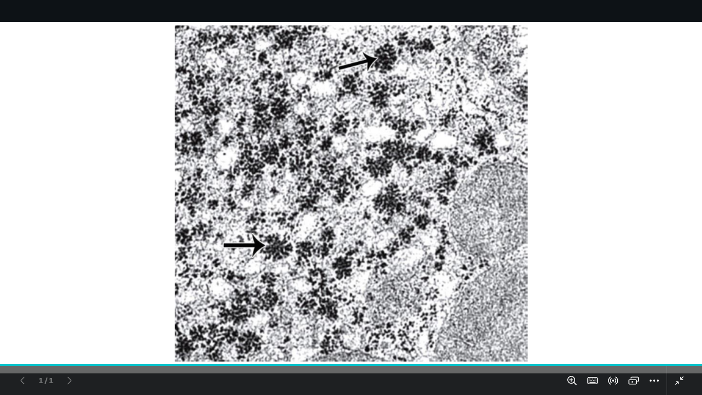 <p>idntify </p><p>mention the type</p><p>name the organ</p>