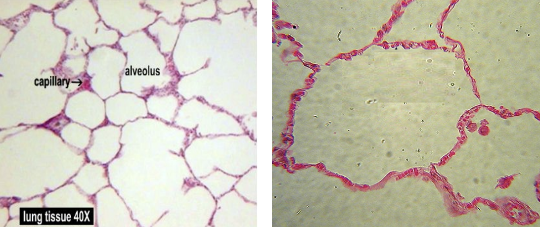 <p>Tissue found in lungs, endothelium of capillaries, blood vessels. Functions include gas exchange and diffusion.</p>