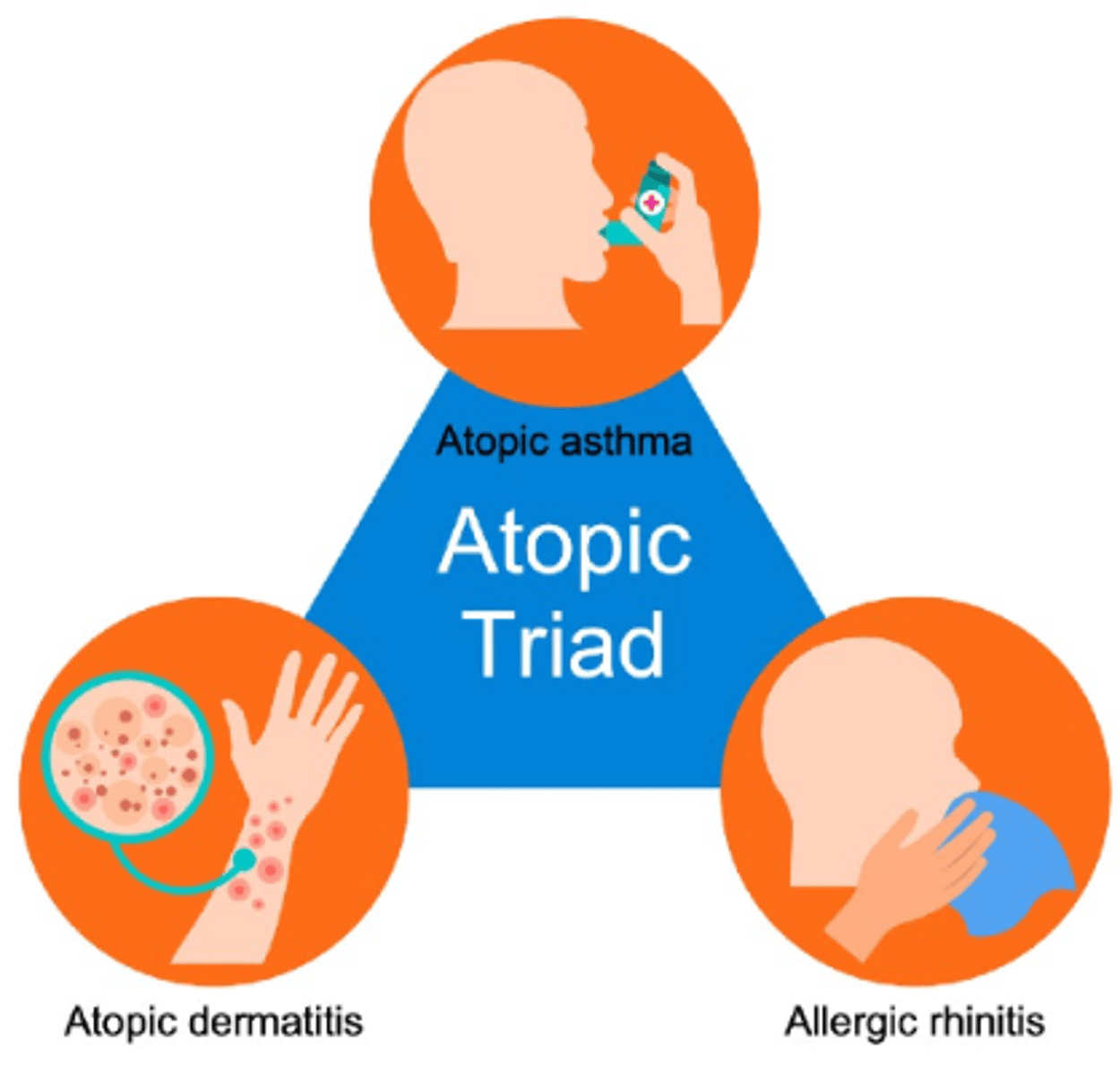 <p>Asthma</p><p>Hay fever (Allergic rhinitis)</p><p>Eczema</p>