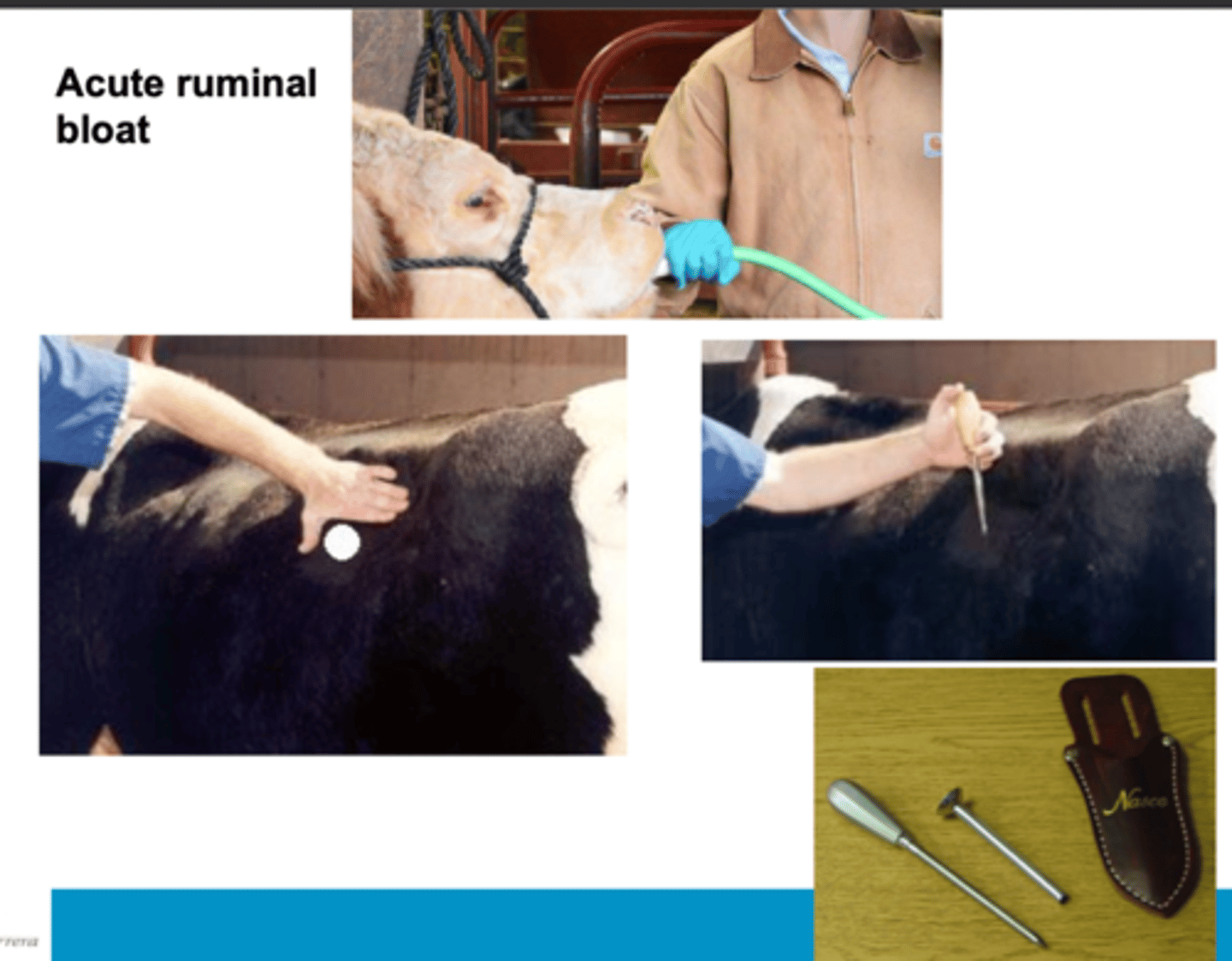 <p>gastroesophageal tube to relieve air in the stomach</p><p>create a hole in the abdomen to release air</p>