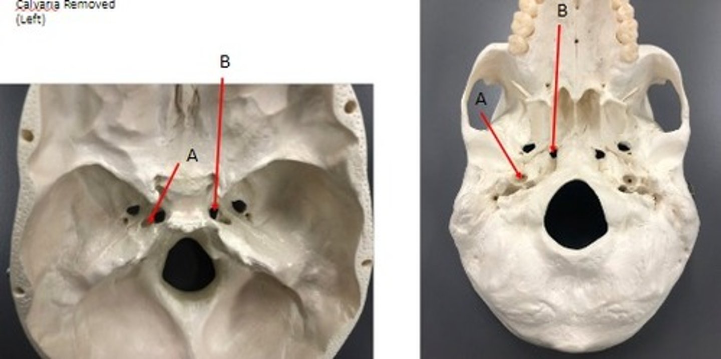 <p>What category of bone is it? What bone is it? Label the structures.</p>