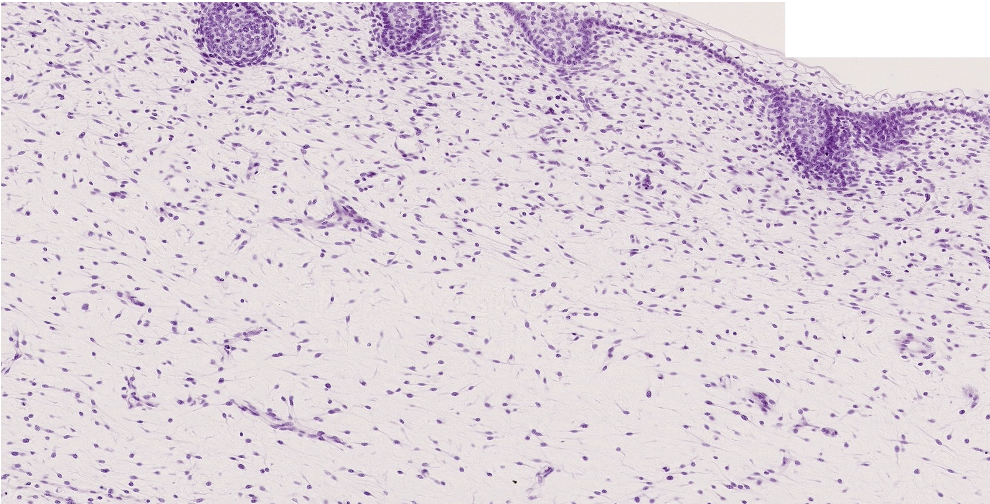 <p>ID the predominate CT in the field of view.</p>