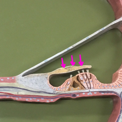 term image