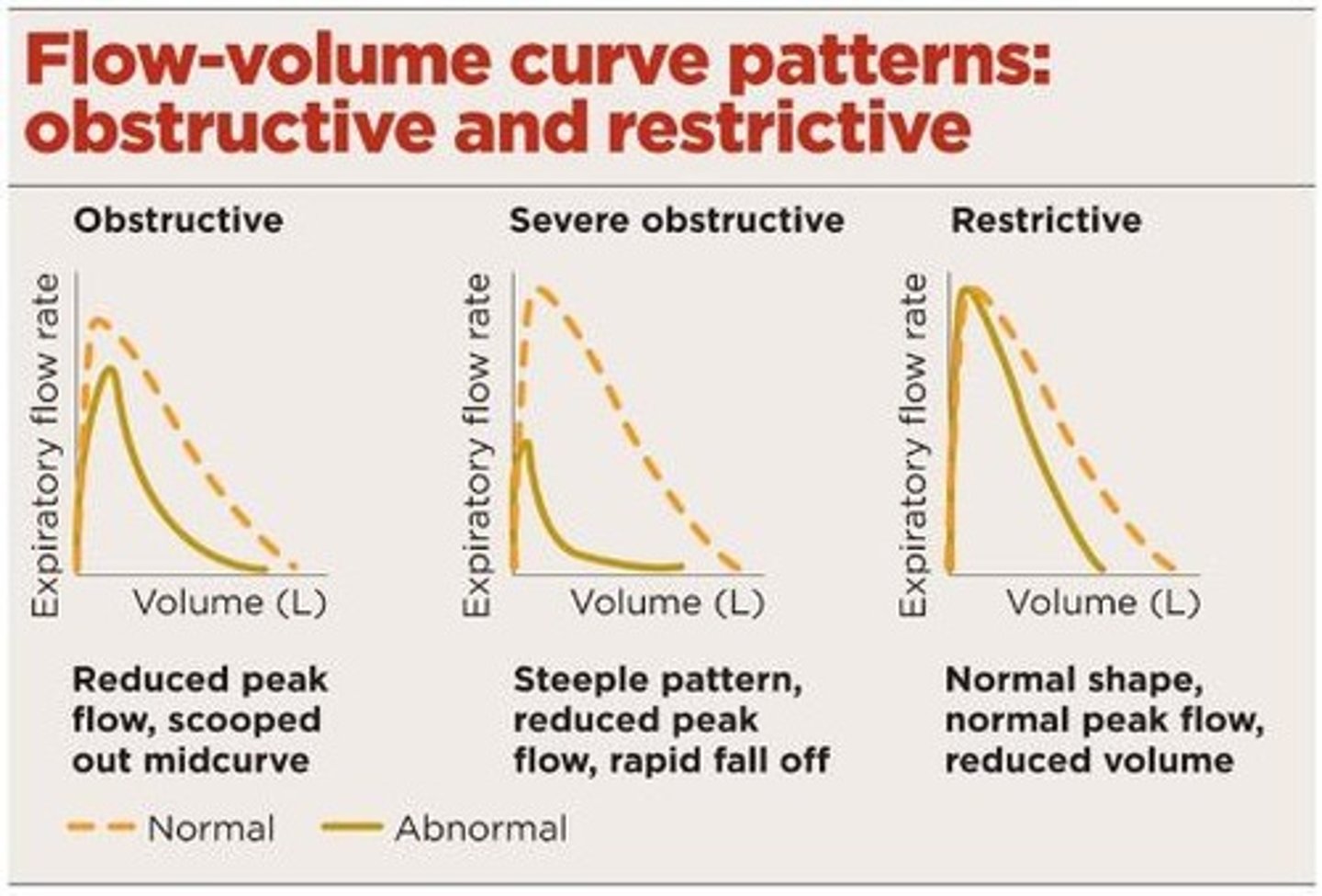 <p>Normal, obstructive (&lt;80% predicted), and restrictive (&lt;80% predicted) patterns based on FEV1 and FVC.</p>