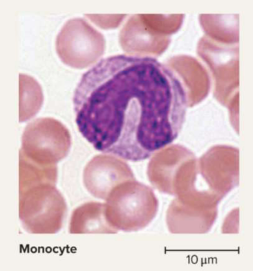 <p>Monocytes</p>