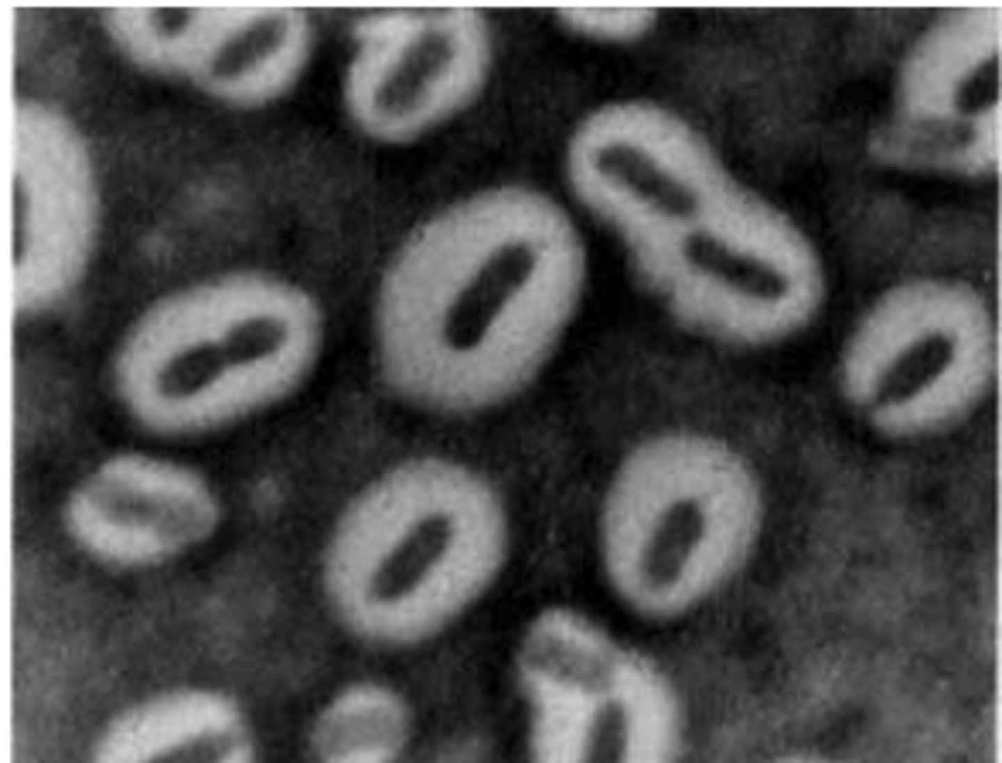 <p>Examine the photomicrograph and prepared slide of an India ink wet mount of____________demonstrating Rod-shaped bacteria with large white capsule</p>