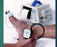 <ul><li><p><span>arterial ultrasound</span></p></li><li><p><span>toe brachial index</span></p></li></ul><p></p>