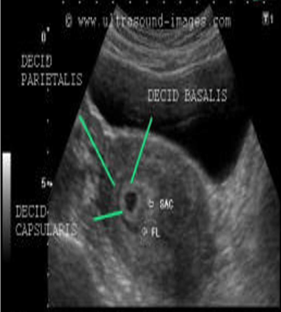 <p>villi; developing embryo (baby side)</p>