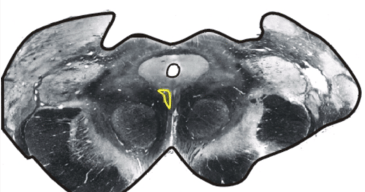 <p>controls eye movements &amp; pupillary constriction</p>