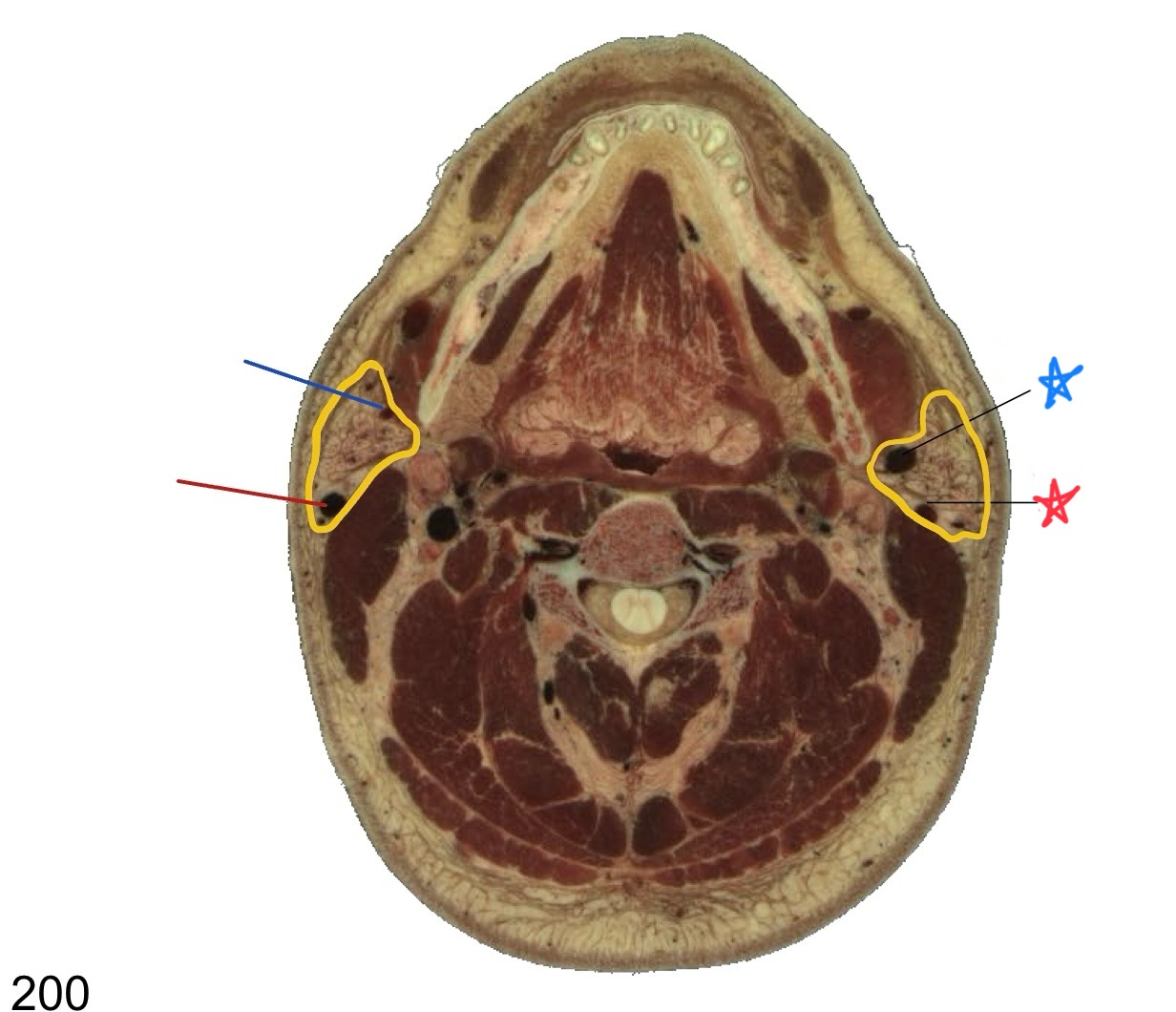 <p>what structure is circled in yellow?</p>