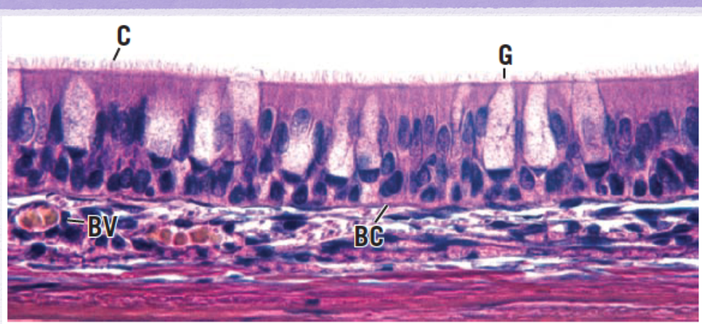 <p>Identify the Epithelium</p>