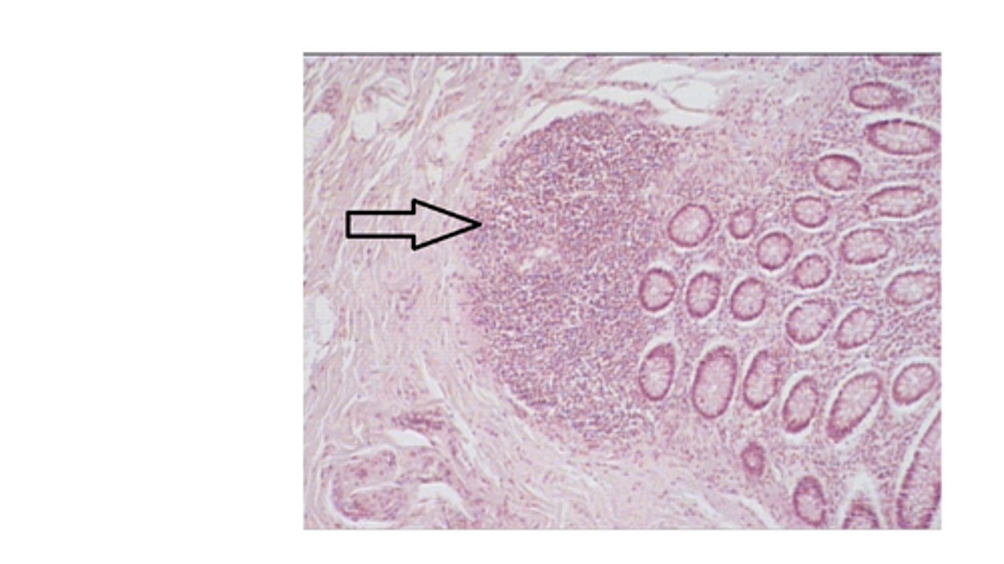 <p>Identify the majority of cell types in this structure?</p>