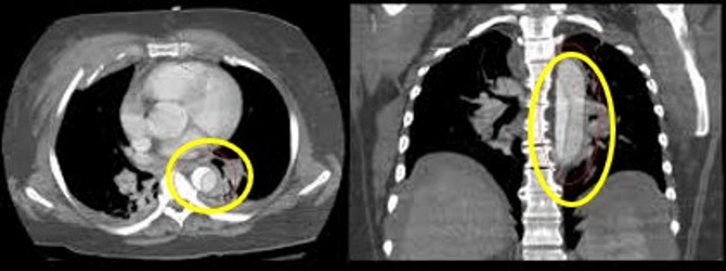 <p>Label pathology in the two images below</p>