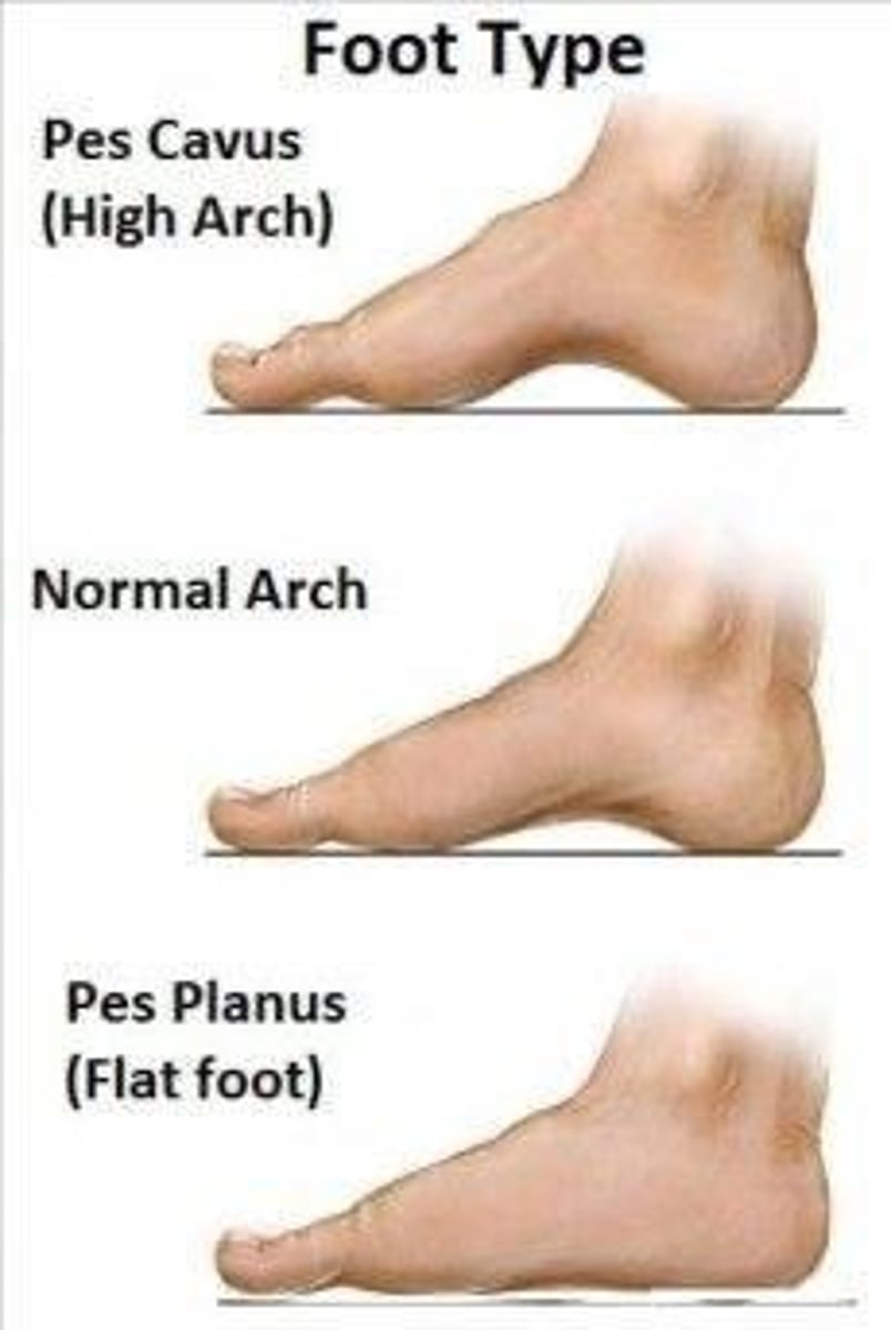 <p>Not pathologies per se, but factors that change normal movement patterns and can facilitate other conditions developing.</p>