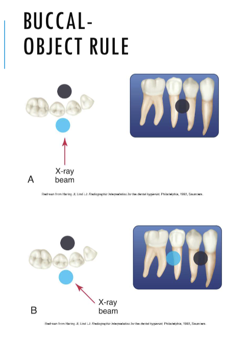 <p>buccal object rule </p>