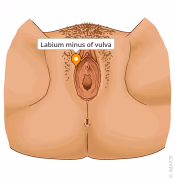 <p>Female (labi.min)</p>