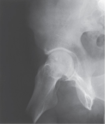 <p>What is the projection and anatomy shown in this image?</p>