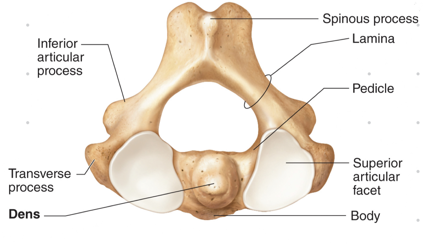 <ul><li><p>body and spinous process</p></li><li><p>dens projects superiorly (where atlas and axis fuse)</p></li><li><p>pivot, side-to-side ROM, shaking head “no”</p></li></ul>