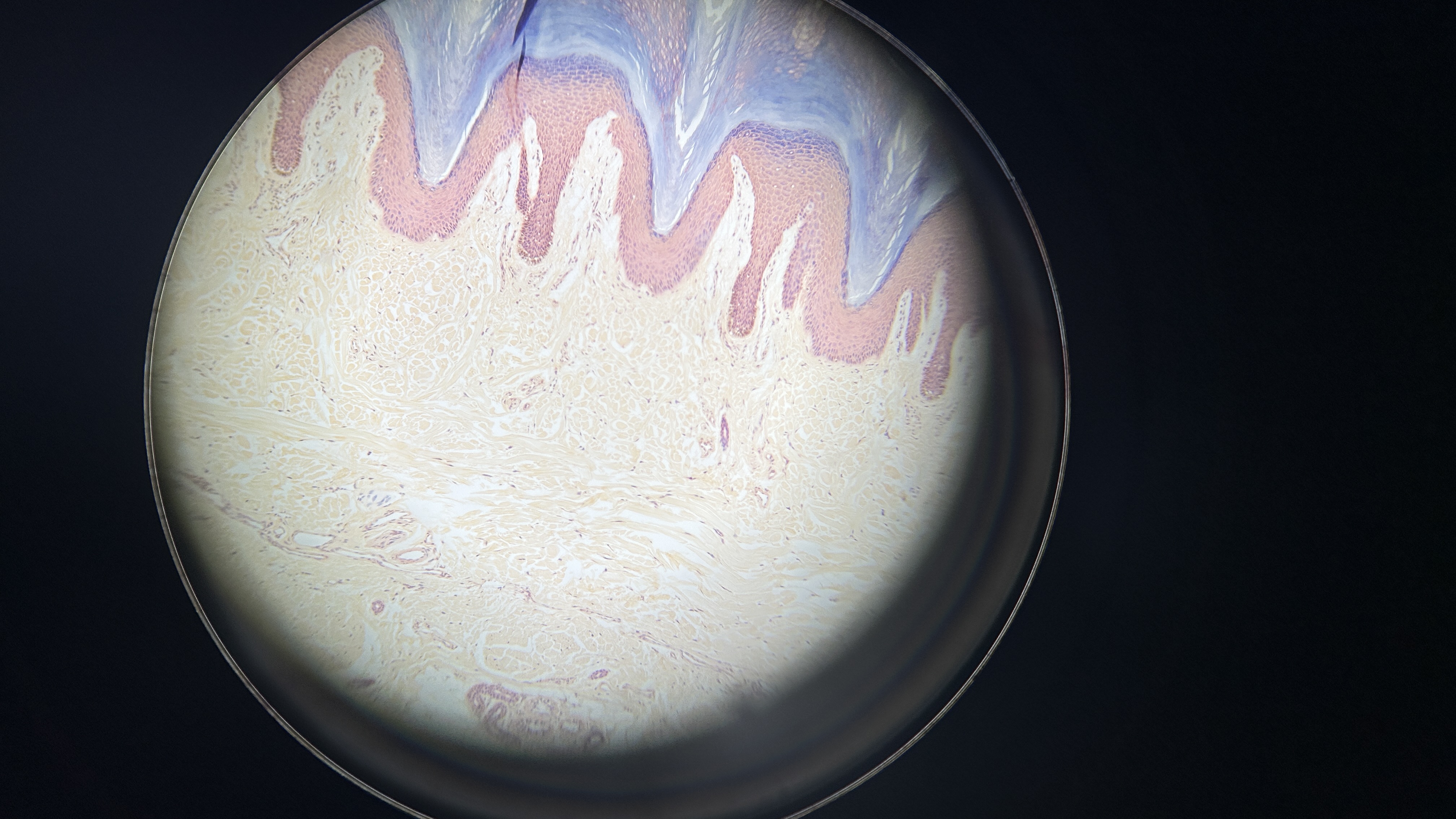 <p>What is the magnification level of the Dense Irregular CT?</p>