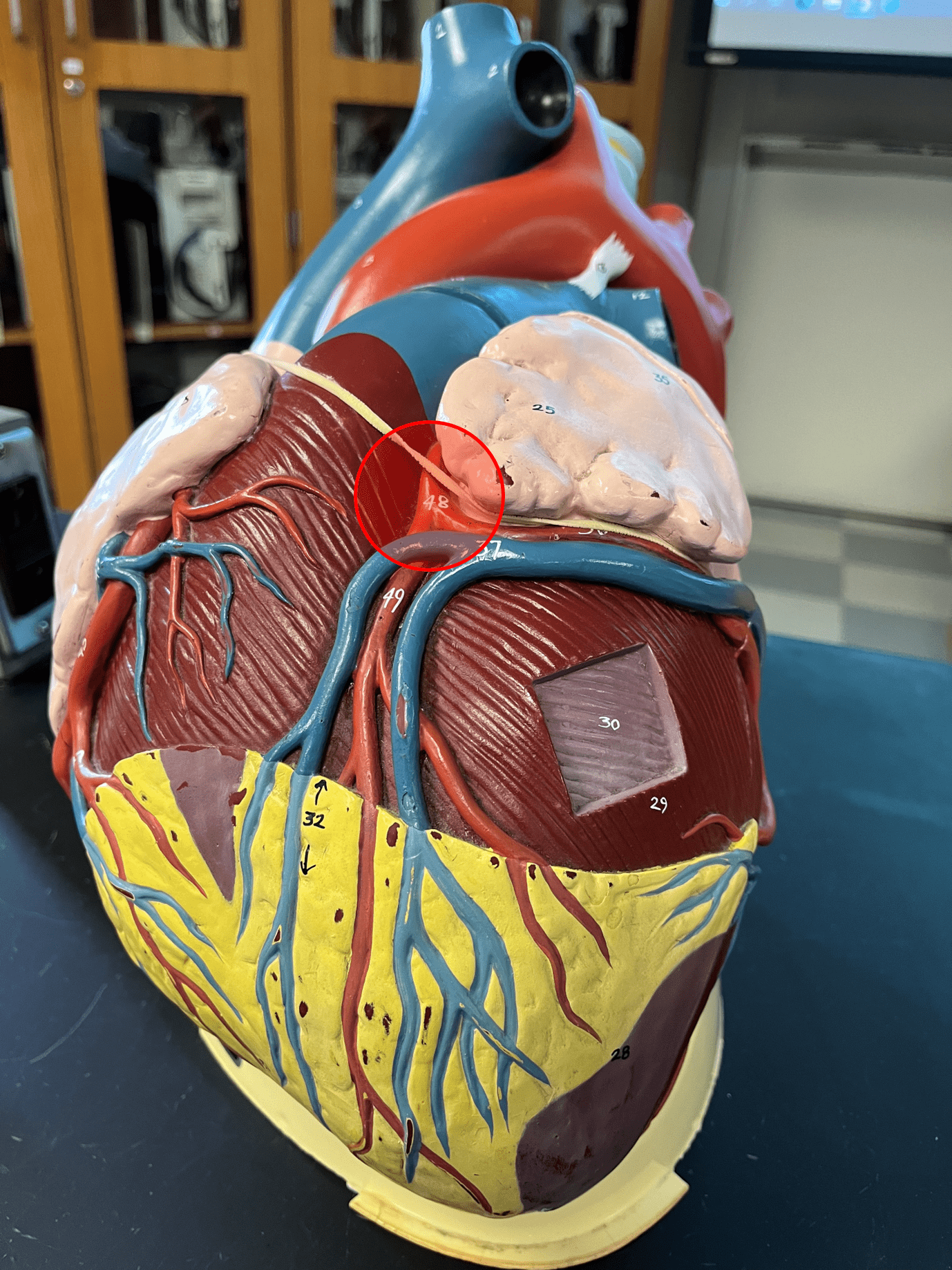 • Part of the coronary circulation.

• Supplies the anterior side of the ventricles and laterodorsal left side of the heart.

• Arises from the base of the aorta.

• Branches into the anterior interventricular and circumflex arteries.