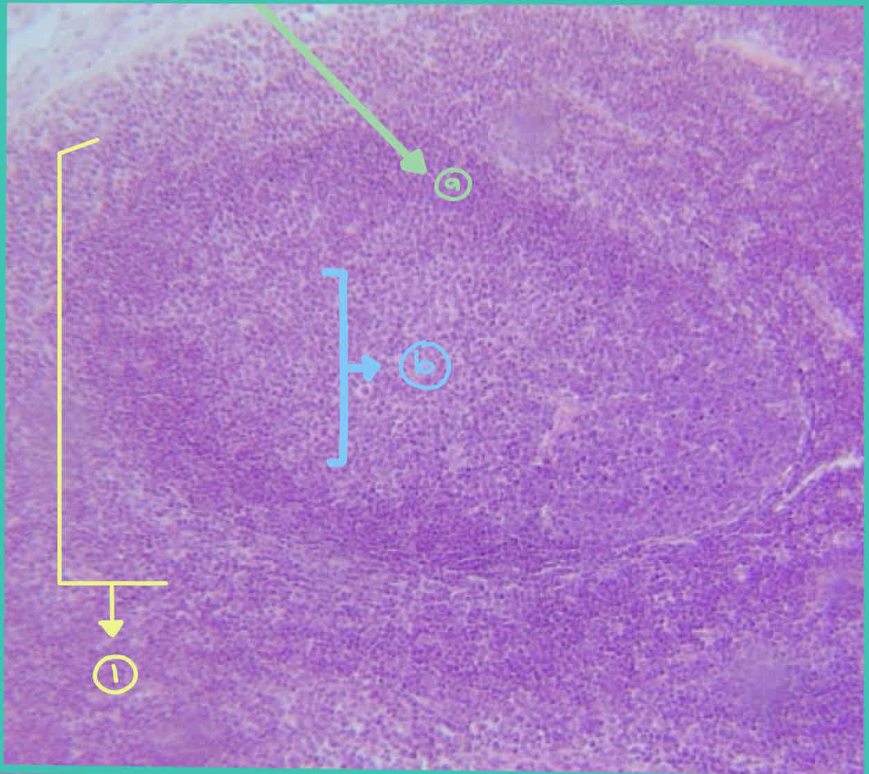 <ol><li><p>Organ</p><p>a.</p><p>b.</p></li><li><p>Preponderant Cell:</p></li><li><p>Preponderant Fibers:</p></li></ol>