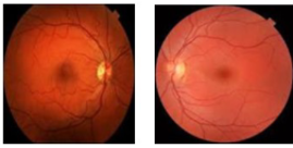 <p>Clinical scenario 2</p>