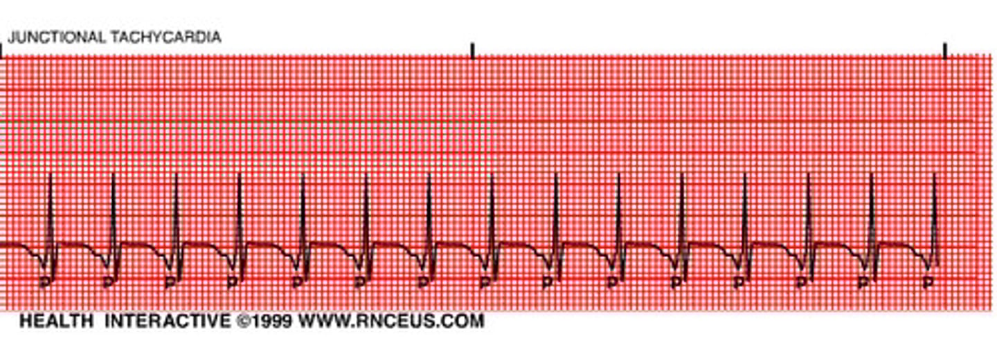 <p>&gt;60 bpm (ms. K; 150-250)</p><p>- KEY: will be regular (consistent)</p><p>- AV junction produces a rapid sequence of QRS-T cycles</p><p>- p-wave often inverted/buried/follow QRS</p>